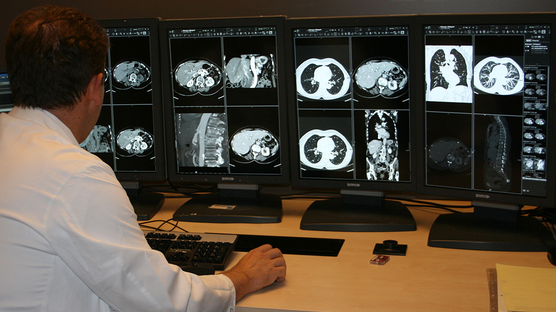 Strengthening the Protection of Patients who Need Multiple Imaging