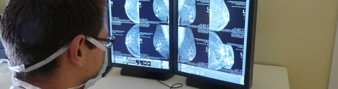 Mammography Exposure Chart