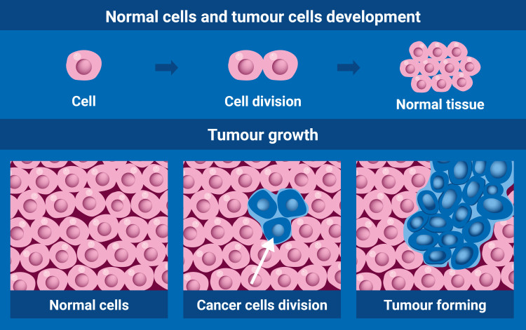 Cancer Cells vs. Normal Cells: How Are They Different?