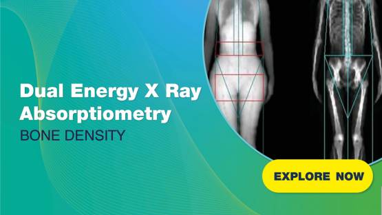 Dexalytics News // Standard X-Ray VS. Dual X-Ray Absorptiometry (DXA) //
