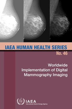 Advanced Radiology Consultants: Mammography